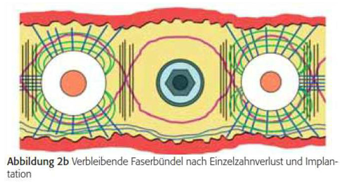 LTS-BASE reduzierte bakterien LTS-BASE reduzierte-bakterien