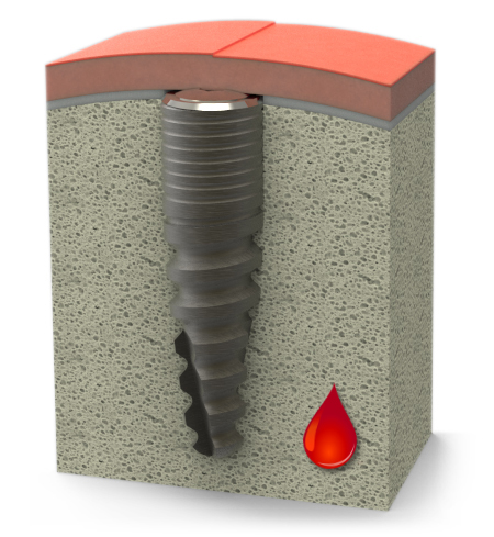 conventional closed healing conventional closed healing
