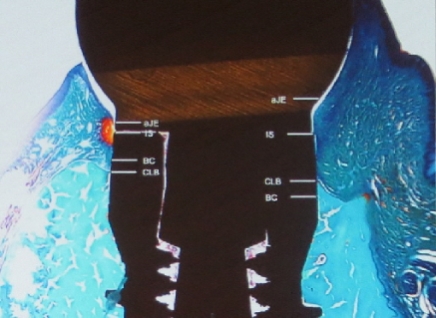 Schwarz Studie Schwarz Studie 1