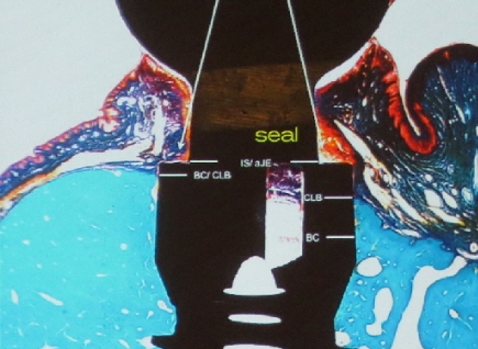 Schwarz Studie Schwarz Studie 2